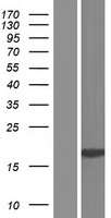 TRAPPC2B (NR_002166) Human Over-expression Lysates TRAPPC2B NR_002166