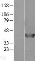 AHA1 (AHSA1) Human Over-expression Lysates NM_012111