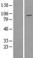 USP16 Human Over-expression Lysates NM_001001992