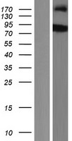 SH2B2 Human Over-expression Lysates NM_020979