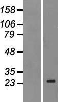 MAD4 (MXD4) Human Over-expression Lysates NM_006454