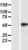 ls010610 st6galnac2 human over expression lysates nm 006456 wb testing 1