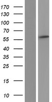 PDLIM5 Human Over-expression Lysates NM_001011513