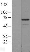 PDLIM5 Human Over-expression Lysates NM_006457