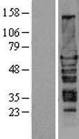 HEXIM1 Human Over-expression Lysates NM_006460