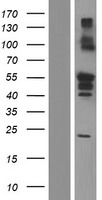 RBCK1 Human Over-expression Lysates NM_006462