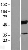 RBCK1 Human Over-expression Lysates NM_031229