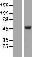 AMSH (STAMBP) Human Over-expression Lysates NM_006463