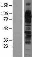 ls010618 tgn46 tgoln2 human over expression lysates nm 006464 wb testing 1