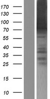 ARID3B Human Over-expression Lysates NM_006465