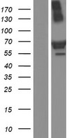 TRIM16 Human Over-expression Lysates NM_006470