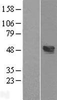 TXNIP Human Over-expression Lysates NM_006472