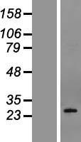 PDPN Human Over-expression Lysates NM_198389