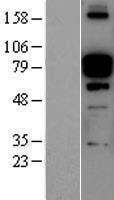 ls010631 periostin postn human over expression lysates nm 001135935 wb testing 1