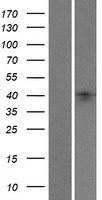 Lefty (LEFTY1) Human Over-expression Lysates NM_020997