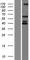 ls010642 igf2bp1 human over expression lysates nm 001160423 wb testing 2