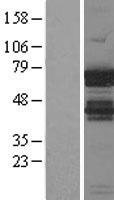 ls010642 igf2bp1 human over expression lysates nm 006546 wb testing 1