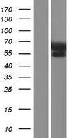 IGF2BP2 Human Over-expression Lysates NM_001007225