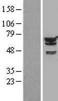IGF2BP2 Human Over-expression Lysates NM_006548