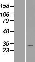 MTX2 Human Over-expression Lysates NM_006554