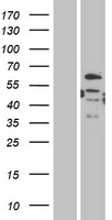 DMRT2 Human Over-expression Lysates NM_181872