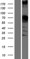 SAM68 (KHDRBS1) Human Over-expression Lysates NM_006559