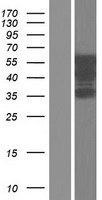 CELF2 Human Over-expression Lysates NM_001083591