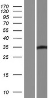 LBX1 Human Over-expression Lysates NM_006562