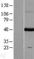 FARS2 Human Over-expression Lysates NM_006567
