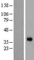 CGR19 (CGRRF1) Human Over-expression Lysates NM_006568