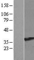 RRAGA Human Over-expression Lysates NM_006570