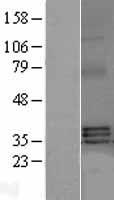 BAFF (TNFSF13B) Human Over-expression Lysates NM_006573