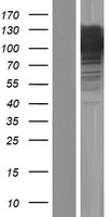 Advillin (AVIL) Human Over-expression Lysates NM_006576