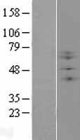 B3GNT1 (B3GNT2) Human Over-expression Lysates NM_006577