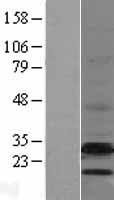 emopamil binding protein (EBP) Human Over-expression Lysates NM_006579