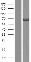 DLL3 Human Over-expression Lysates NM_016941