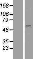 ls010693 cct6b human over expression lysates nm 006584 wb testing 3