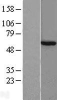 TCP1 theta (CCT8) Human Over-expression Lysates NM_006585