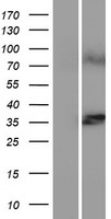 Ceramide synthase 1 (CERS1) Human Over-expression Lysates NM_198207