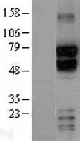 TBR1 Human Over-expression Lysates NM_006593