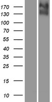 KCC4 (SLC12A7) Human Over-expression Lysates NM_006598