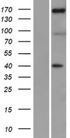 ls010725 nfat5 human over expression lysates nm 001113178 wb testing 1
