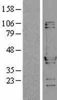 NUDC Human Over-expression Lysates NM_006600