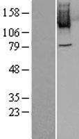 PLK4 Human Over-expression Lysates NM_014264