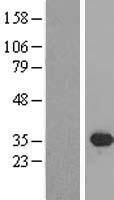 SIX2 Human Over-expression Lysates NM_016932