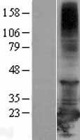 RBBP9 Human Over-expression Lysates NM_006606