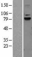 Calpain 9 (CAPN9) Human Over-expression Lysates NM_006615