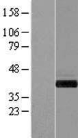 GIPC (GIPC1) Human Over-expression Lysates NM_202468