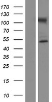 NUP50 Human Over-expression Lysates NM_153645