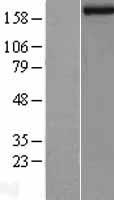 ls010765 kdm5b human over expression lysates nm 006618 wb testing 1